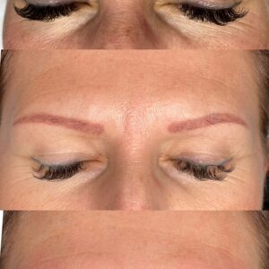 Laserowe Usuwanie Makijażu Permanentnego