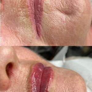 Modelowanie Ust Dojrzałych